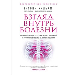 Взгляд внутрь болезни. Все секреты хронических и таинственных заболеваний и эффективные способы их полного исцеления (2-е издание)