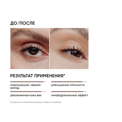 ICON SKIN Крем-гель для кожи вокруг глаз от отеков EYES YOGA, 20 мл