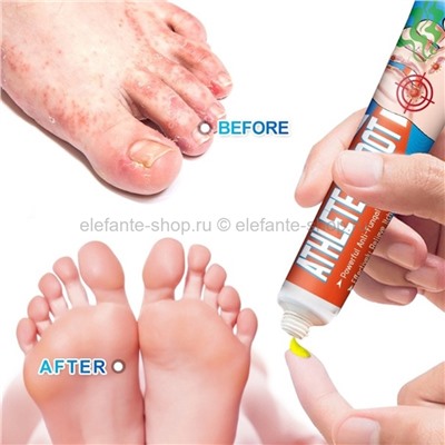 Крем от мозолей и запаха ног Sumifun Athletes Foot Cream 20g (106)