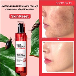 Тонер с муцином чёрной улитки Some By Mi Snail Truecica Miracle Repair 135ml (51)