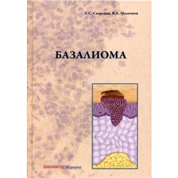 Базалиома. Снарская Е.С., Молочков В.А.