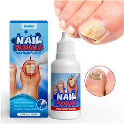 Эссенция от грибка ногтей Sumifun Nail Fungus 20мл