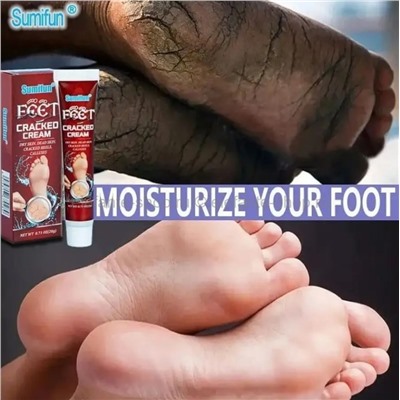 Крем для поврежденной кожи Sumifun Feet Cracked Cream 20g (106)