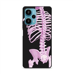 Матовый силиконовый чехол Pink skeleton на Poco F5