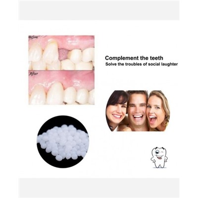 Накладка на зубы "Клыки, временная пломба", в гранулах, 10 г в пакете 9046552