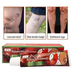 Антиварикозный крем ZB Varicose Viens Ointment 30g (106)