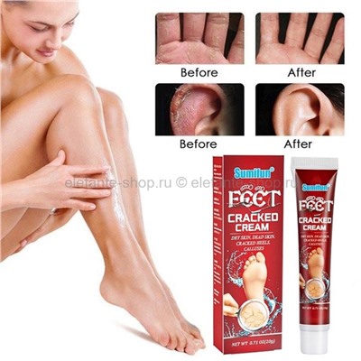 Крем для поврежденной кожи Sumifun Feet Cracked Cream 20g (106)