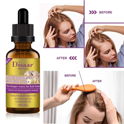 Эссенция для роста волос ИМБИРЬ Disaar Hair Essential Oil Anti Hair Loss 30мл