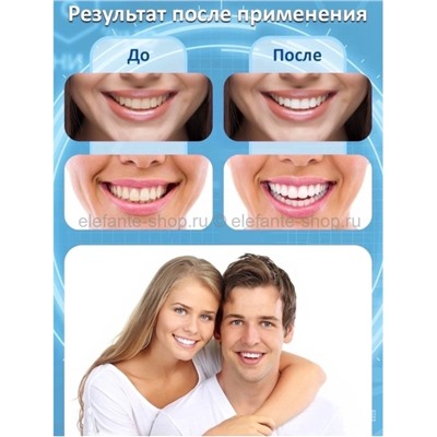 Отбеливающие полоски для зубов 3D Teeth Whitening Strips 7 штук (28)